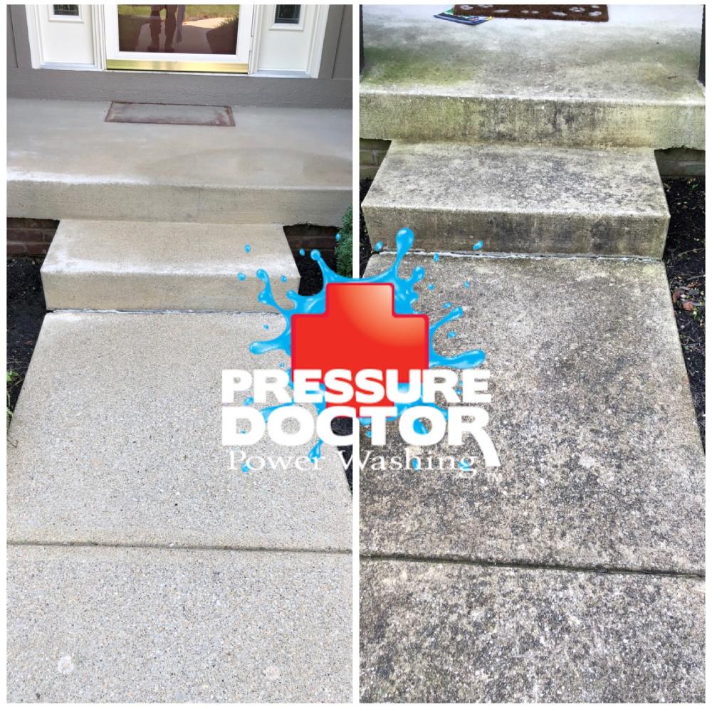 before and after pressure washed concrete steps with pressure doctor logo
